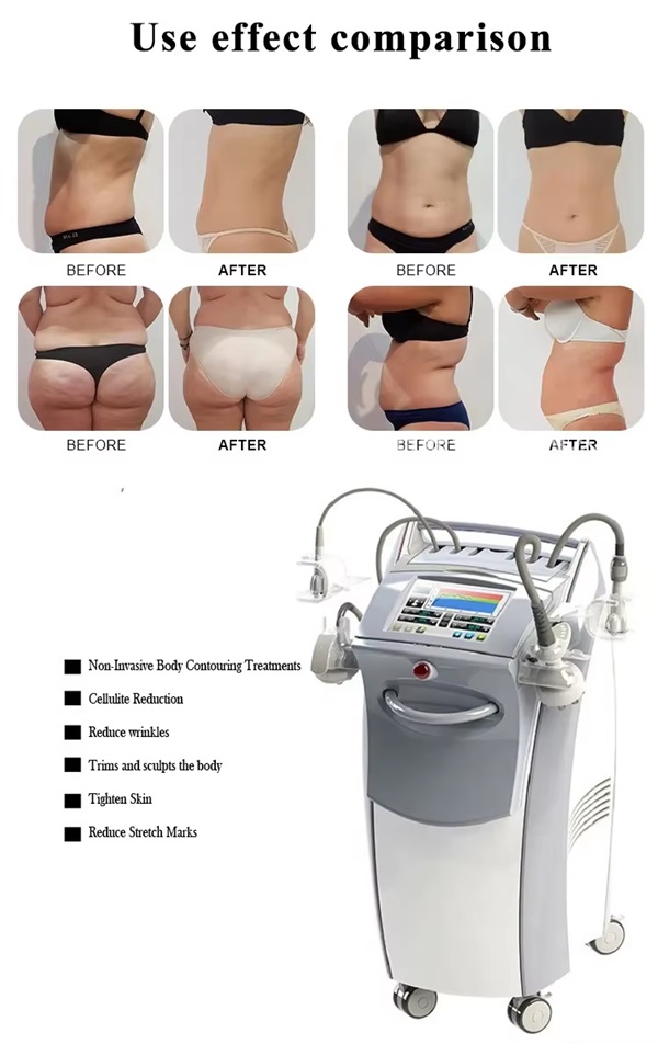 Body Sculpt Contour Machine For Beauty Equipment Professional
