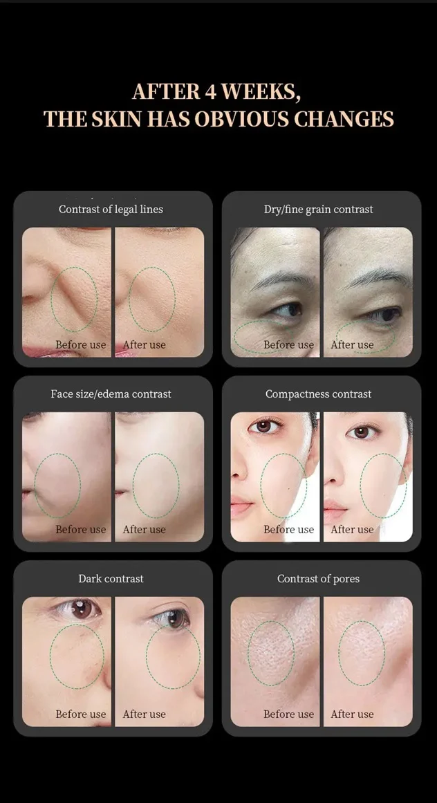 Facial Lift Beauty Skin Instrument