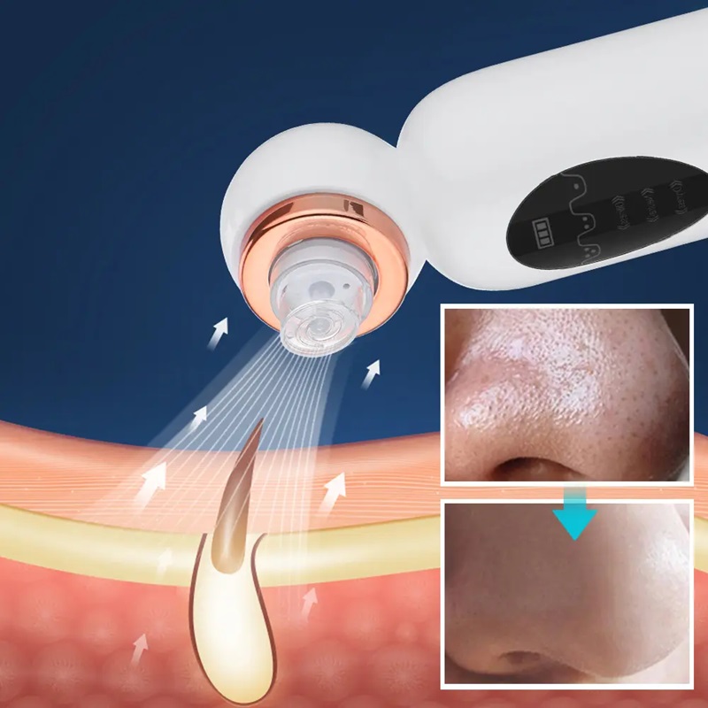 Pore Vacuum Blackhead Remover